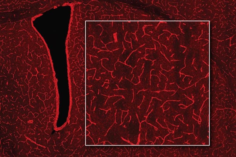 Detect Bioluminescence in the Brain Using Magnetic Resonance Imaging